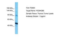 PCDHGB5 Rabbit anti-Human, Polyclonal, Novus Biologicals 0.1 mL | Buy Online | Novus Biologicals | Fisher Scientific